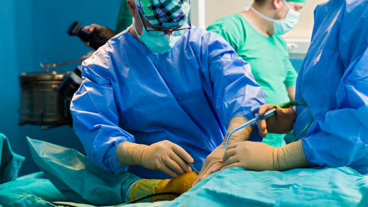 An orthopedic surgery in progress with a medical device kit open.